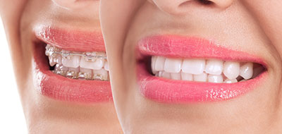 Smiling woman with pink lipstick and teeth, showcasing dental health and cosmetic enhancement.