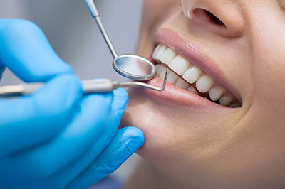 A dental professional performing teeth cleaning or a similar procedure on a patient, with the patient s mouth open and a dental pick visible.