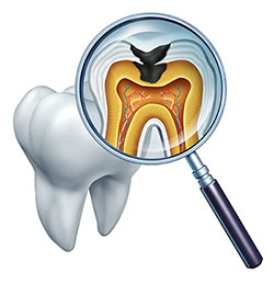 A digital illustration depicting a magnified view of a tooth s interior, with an X-ray revealing the dental pulp and root system, set against a white background.