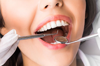 A woman with open mouth, receiving dental care with a metal tool in her mouth.