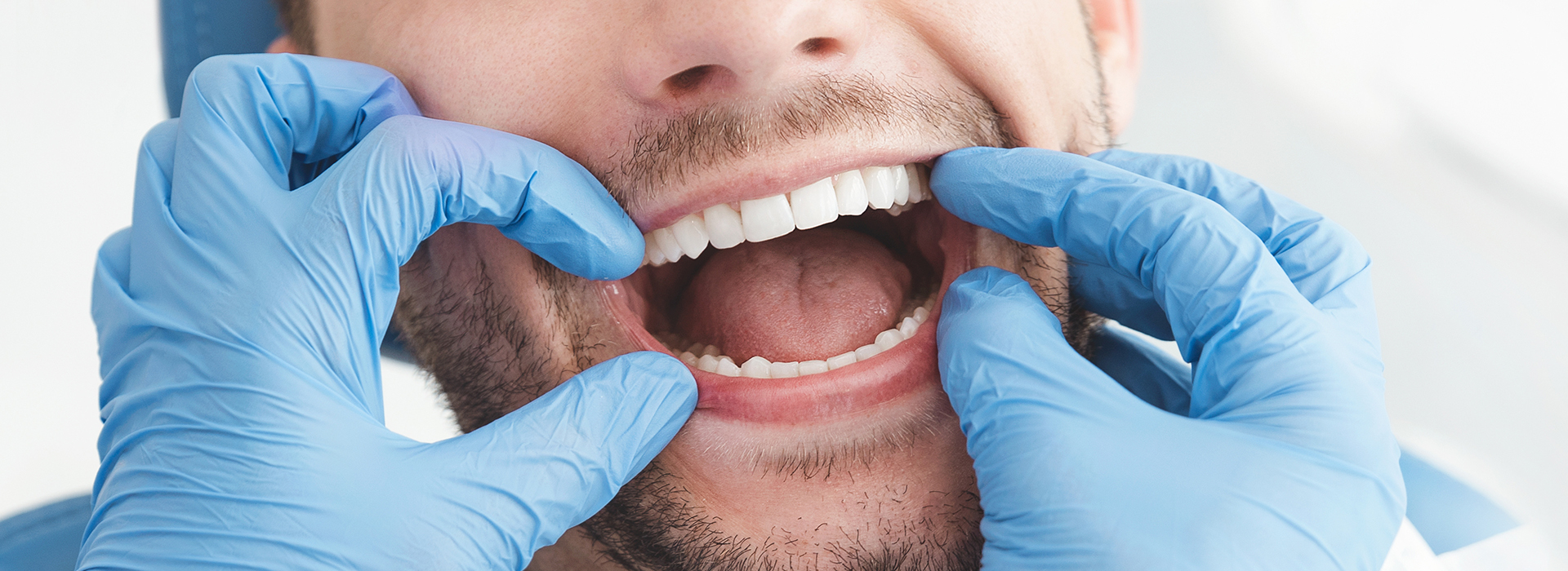 The image is a photograph of a man in a dental setting, wearing gloves and holding his mouth open with one hand while the other hand is placed over his teeth. He appears to be smiling as he looks directly at the camera.