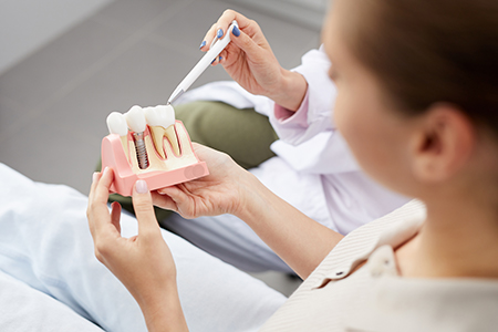 A dental professional holding a tooth model with a scalpel, preparing to demonstrate a dental procedure.